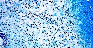 The 15 most common nervous system diseases - yes, therapy helps!