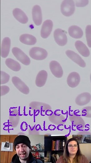 Elliptocyte & Ovalocyte Morphological Characteristics
