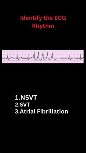 🫀Test your ECG skills in 15 seconds 👨‍⚕ #ecg #dailyceg #medical #shorts