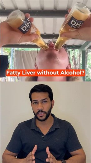 Fatty Liver Without Alcohol Explained ! #health #nutrition #liver