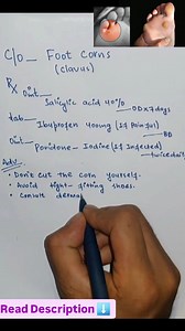 UPDATEDPHARMACY on Instagram: "👣 Foot Corn Treatment Prescription 🔖 For external use only unless otherwise advised by a physician. 🧴 1. Ointment Salicylic Acid 40% (Keratolytic Agent) 🔹 Dose: Apply a thin layer over the corn once daily after soaking the foot in warm water for 10–15 minutes. Cover with a corn plaster or soft dressing. 🔹 Use Mechanism: Softens and breaks down the thickened skin layer by dissolving keratin, allowing gradual removal of the corn. ⚠️ Warning: Do not apply to brok