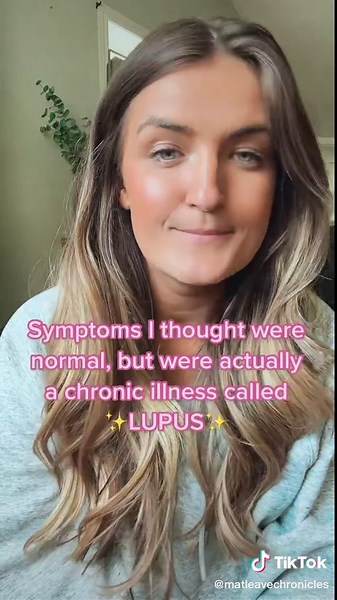 Understanding Lupus Symptoms: A Personal Journey