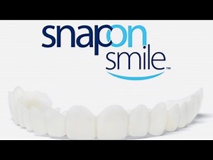 Snap-on-Smile for $50.00!!!!!!!!!
