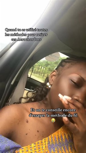 Méthodes pour Retirer les Acrochordons