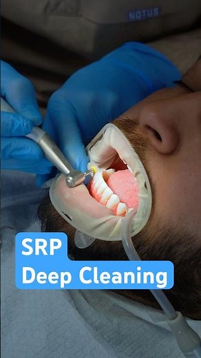 What is a dental deep cleaning or SRP?