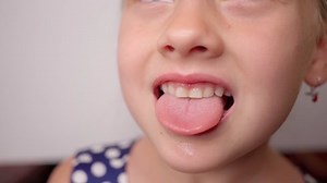girl opens her mouth wide and pulls out long tongue. child shows his teeth and mouth to dentist. mouth is wide open, tongue is stuck out as far as possible, with clear view of tongue and soft palate