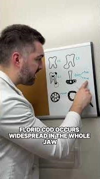 Radiopacities in 90 SECONDS! #dentalstudent #boardexam