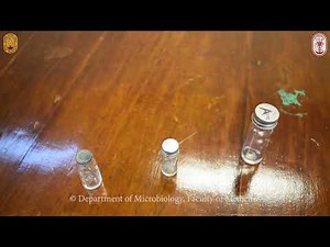 CSF specimen collection