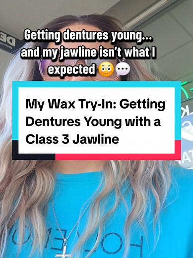 Getting dentures at a young age isn’t talked about enough. Yesterday was my wax try-in — the step before my permanent dentures are made. 🦷 I absolutely loved how my tops looked, but the bottoms didn’t line up right when I bit down. My dentist explained I have what’s called a Class 3 jawline, meaning my bottom jaw sits forward. It’s all part of the process, and I’m so excited for my next step when they finalize them at the lab! 🙌 I’ll keep sharing the full process — the pros, the cons, and what