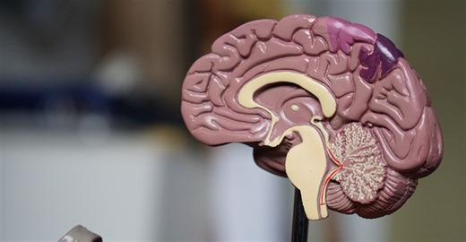 MSc Applied Neuropsychology | Study at Bristol | University of Bristol