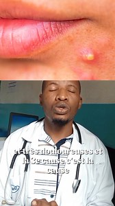165K views · 10K reactions | Voici les 3 causes des boutons de visage qu'on appelle acné. Si vous avez ne fusse qu'un seul bouton sur votre visage vous devez impérativement voir ça. #acne #peauparfaite #skincare #peausaine #ConseilSanté | Dr Best | Facebook