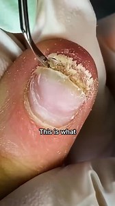 2.2K reactions · 118 shares | Feet smelling like yesterday's nachos?...