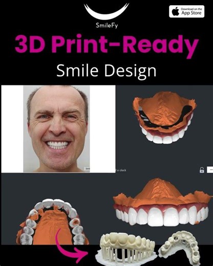 Smilefy ONE-CLICK Smile Simulation + 3D Treatment Plan in Minutes