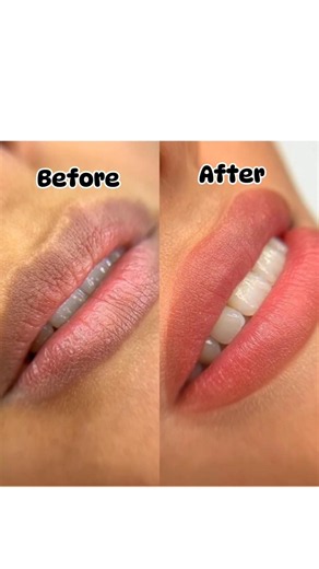 Soft, pink lips naturally 💖 Try this 3-ingredient remedy tonight! ✨ #darklips #homeremedy #shorts