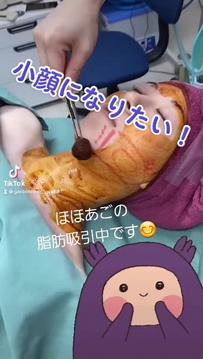 TikTokでガーデンクリニック大阪院さんをチェック！