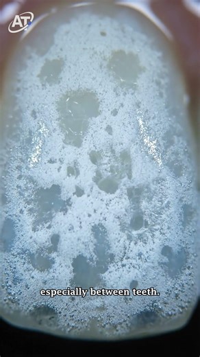 How Floss Protects Your Teeth and Saves Your Smile