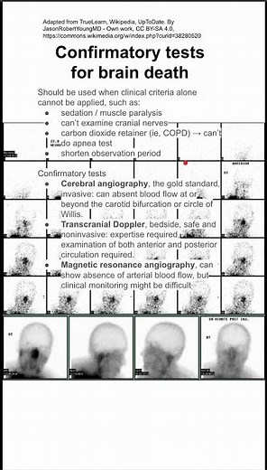 Confirmatory tests for brain death