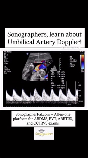 LINK IN BIO! Umbilical Artery Doppler: normal vs abnormal flow (and why it matters). These examples are pulled directly from our SonographerPal.com OB/GYN Placental and Umbilical Cord Abnormalities study guide. Most OB Doppler board questions come down to one concept: placental resistance. As pregnancy progresses, the placenta should act like a low-resistance pathway — meaning the umbilical artery waveform should show forward flow during diastole. Normal (low-resistance) UA waveform: \t•\tForwar