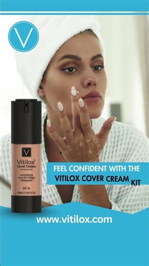 Vitilox® Cover Cream long-lasting coverage for vitiligo patches