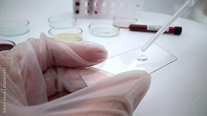 4K, Work lab testing for infectious coronavirus. COVID-19 pandemic outbreak prevention concept. Virology science testing. Science testing for influenza transmission. Close up of microscope slide-Dan