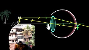 Human eye: accommodation and near point