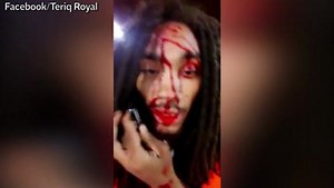 Teriq Royal posts video after being shot in the head