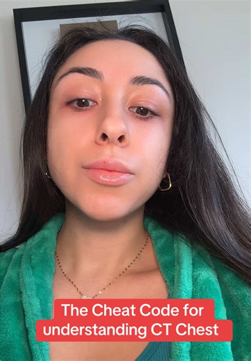 Helping you understand CT Chest! Comment if you want a part 2! #radiology #pulmonary #radiologytiktok #medicaleducation #medtok