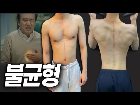 n년 동안 돌고 돌아 찾은 비대칭 해결책