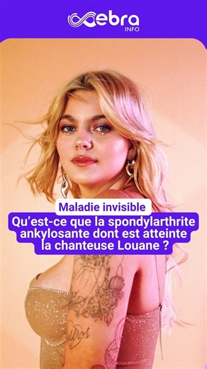 11K views · 39 reactions | Dans un podcast, la chanteuse Louane révèle être atteinte d’une maladie auto-immune rare : la spondylarthrite ankylosante. Elle raconte vivre avec des douleurs constantes et un handicap invisible. Une maladie qui touche plus de 200 000 jeunes en France. #ebrainfo | Le Progrès | Facebook
