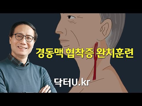 목 혈관 두께 , 경동맥 초음파 , 경동맥 스텐트보다 반드시 먼저 해야 하는 것 ! : 닥터U의 ' 경동맥 협착증 완치훈련 '