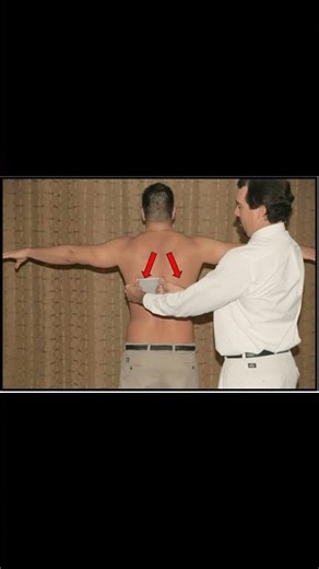 🦴 Lateral Scapular Slide Test Explained #shoulderpain #meded #ortho #ATC #physio