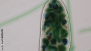Frontonia sp. is a genus of free-living unicellular ciliate protists under the microscope.