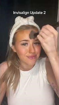 Week 2 Progress #fyp #foryou #foryoupage #invisalign