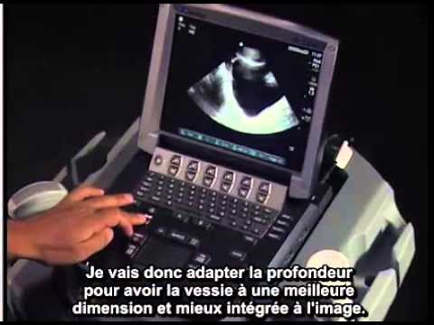 Comment : Réaliser un examen échographique FAST du pelvis masculin