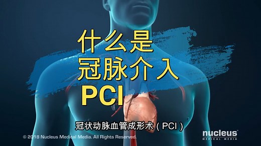什么是冠脉介入PCI，心脏支架有什么用