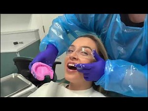 Alginate Impression Taking