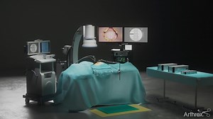 Arthrex Ultra-Minimally Invasive Spine Portfolio Overview