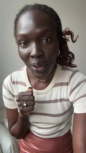Understanding Black Gums and Cultural Perspectives