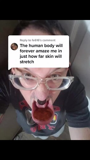 Stretched Labret Tunnel Transformation