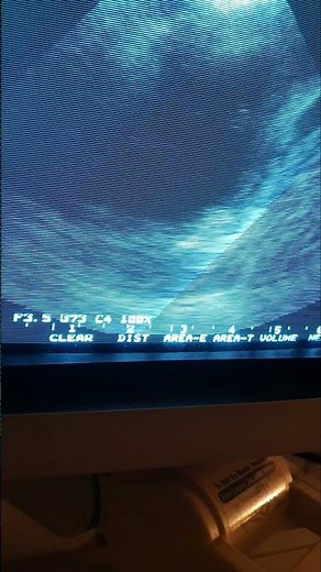 Female heart, ultrasonic view, heartbeat sound