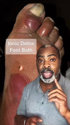 Effective Ionic Detox Foot Bath for Healthy Feet | DC Foot Doctor
