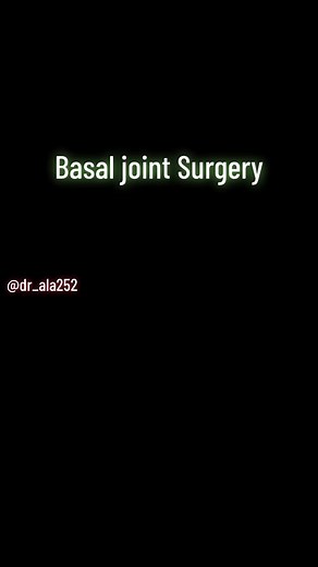 Basal joint Surgery #dr_ala252 #viral #doctor #surgery #foryou #fyp #pleaseunfreezmyaccunt🙏🏻 #fypシ #hospital @StarAnonymous @DR_Ayubi @DR_ALA