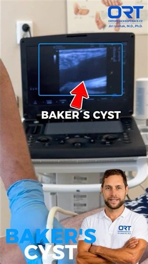 💉 Draining a Baker's Cyst