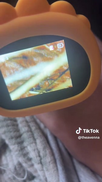 Discover the Fun of USB Microscopes for Kids