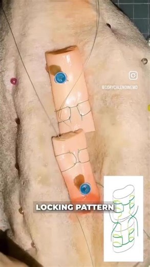 Tendon stitch #doctorinthemaking #mbbsabroad #mbbslife