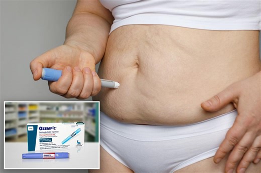 Potentially fatal side effect of weight-loss drugs sparks new investigation