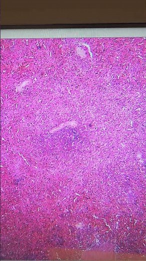 Microscope Slide of the Spleen