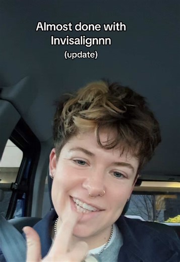 I’m learning that maybe I have a teeth praise k**k #invisalign #teeth #dentist #fyp #journey