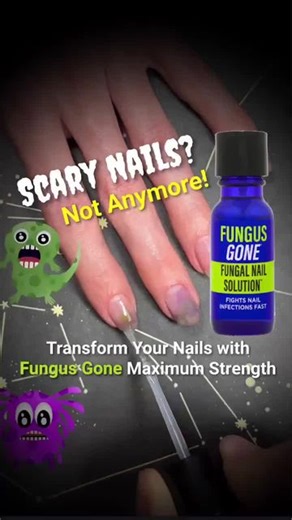 Nail-Aid | 👽 Say goodbye to scary nails with Fungus Gone Maximum Strength! Just in time for the Alien premiere, turn your nail nightmare into a sci-fi... | Instagram