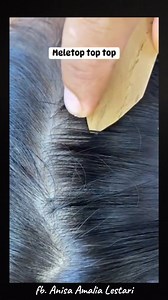 #lice #tick #kuto #reelskuto | Anisa Amalia Lestari